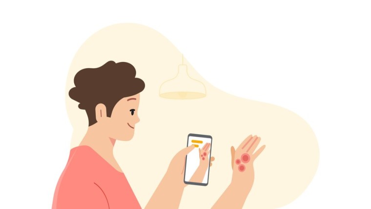 A graphic of a person using their phone camera to detect skin conditions